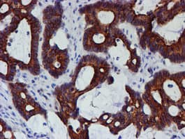 MEF2C Antibody (clone OTI2F2)