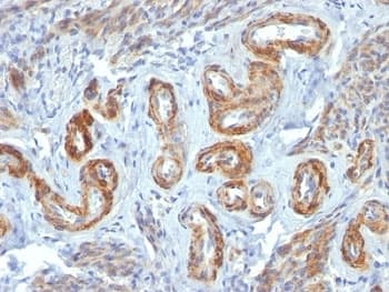 SMMHC / MYH11 Antibody (clone ID8)