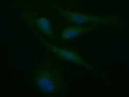 SYP / Synaptophysin Antibody (clone OTI2A10)