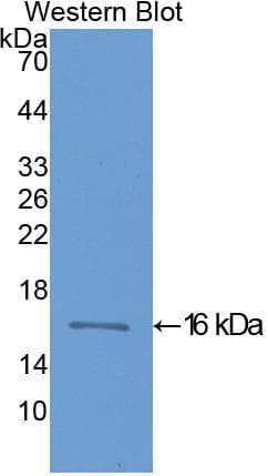 FABP3 / H-FABP Antibody (aa1-133)