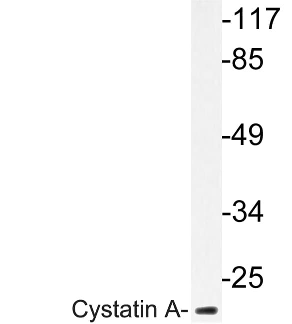 CSTA / Cystatin A Antibody (Gly84)