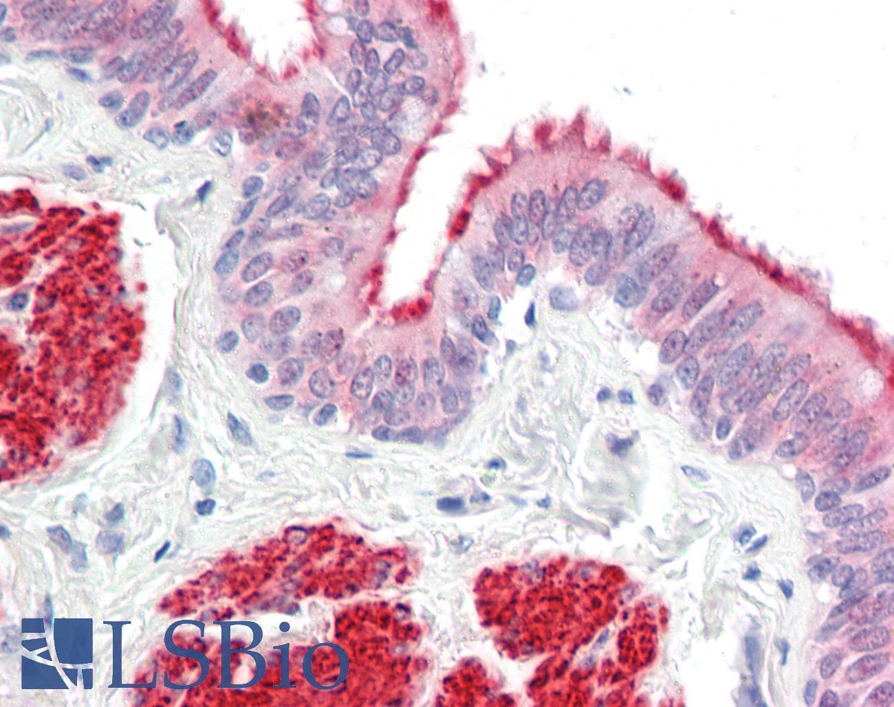 IHC-plus™ LMX1A Antibody