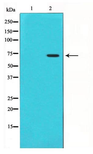 Polyclonal Rabbit anti-Human PTGS1 / COX-1 Antibody (IHC, WB)