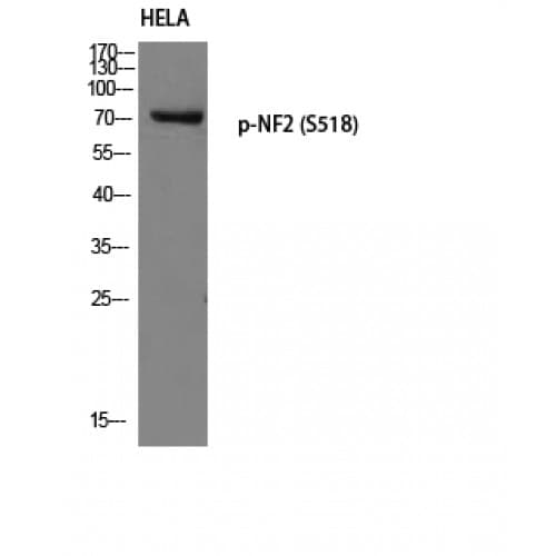 NF2 / Merlin Antibody (460-540 aa)
