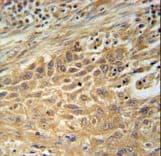 Polyclonal Rabbit anti-Human CNNM4 Antibody (aa565-593, IHC, WB)