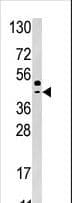 Polyclonal Rabbit anti-Human SEPHS2 Antibody (aa171-201, IHC, WB)