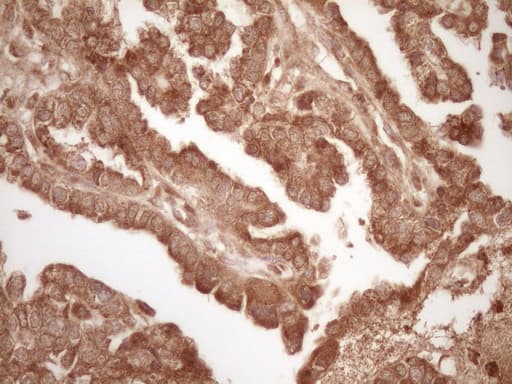 BCL2 / Bcl-2 Antibody (clone OTI9D3)