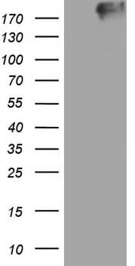 TG / Thyroglobulin Antibody (aa20-358, clone OTI1G4)