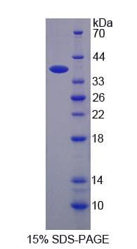 Human SLC12A1 / NKCC2 Protein (Recombinant His-S)