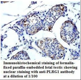 PLRG1 Antibody (aa241-451)