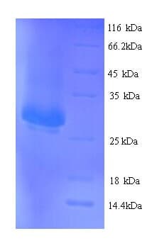 Human ITGA2B / CD41 Protein (Recombinant His)