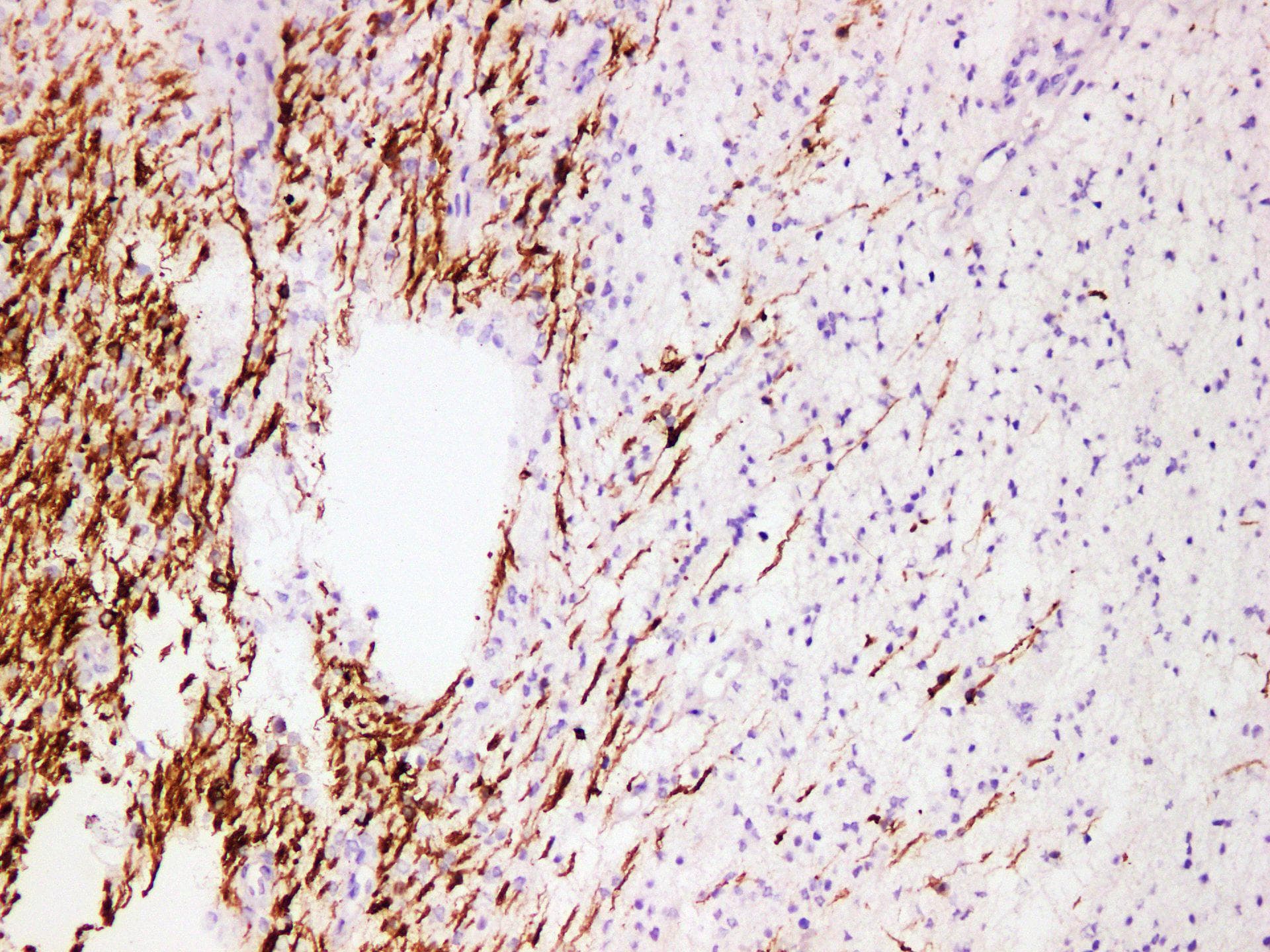 Monoclonal Mouse anti-Human MBP / Myelin Basic Protein Antibody (IHC)