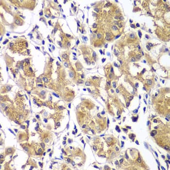 Polyclonal Rabbit anti-Human DGKE / DGK Epsilon Antibody (IHC, WB)