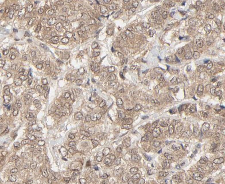 NEDD8 Antibody