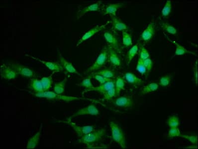 SFN / Stratifin / 14-3-3 Sigma Antibody