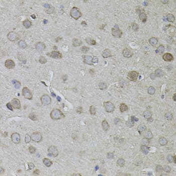 Polyclonal Rabbit anti-Human CKAP4 Antibody (AP, IHC, WB)