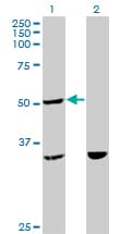 Monoclonal Mouse anti-Human TTC4 Antibody (clone 1E10, WB)