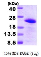 Human BAALC Protein (Recombinant His)