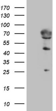 Monoclonal Mouse anti-Human NT5E / eNT / CD73 Antibody (clone OTI1G2, aa119-232, IHC, WB)