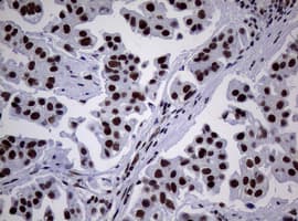 NBN / Nibrin Antibody (clone OTI1F11)