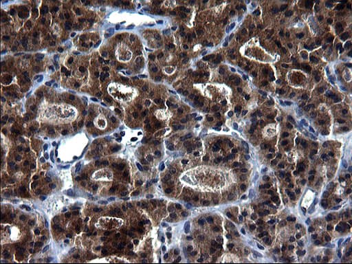 Monoclonal Mouse anti-Human HSCB Antibody (clone OTI3E1, IHC, WB)