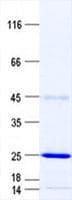 Human TTDN1 Protein (Recombinant His, N-Terminal)