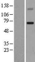 MMP15 Protein (Over-Expression Lysate Myc-DDK (Flag))