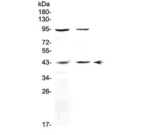 KISS1R / GPR54 Antibody