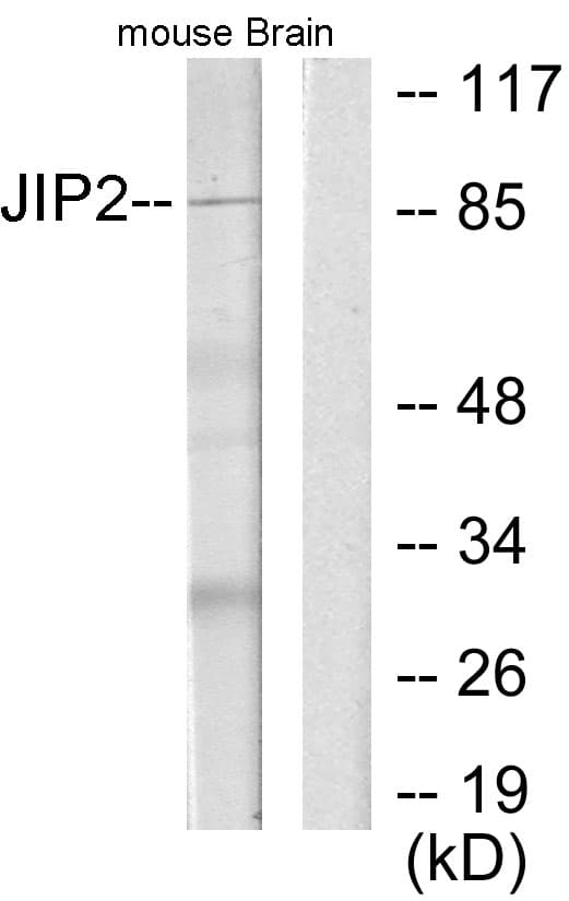 MAPK8IP2 / JIP2 Antibody (aa581-630)