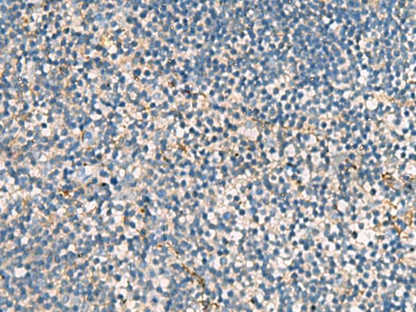 ACTC1 / Alpha Cardiac Actin Antibody