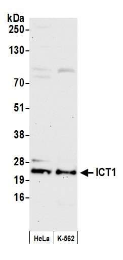 ICT1 / DS1 Antibody (aa156-206)