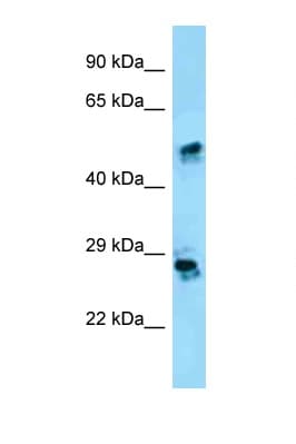 Polyclonal Rabbit anti-Human CRISP1 Antibody (aa75-124, WB)
