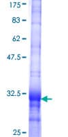 Human SLC25A18 Protein (Recombinant GST, N-terminus)
