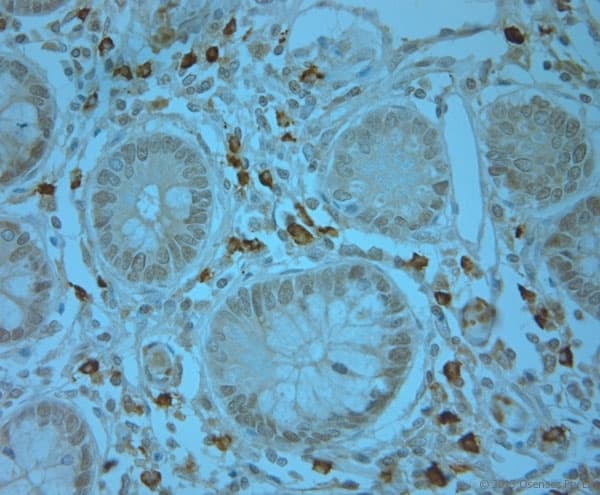 Polyclonal Rabbit anti-Human ERK1 + ERK2 Antibody (phospho-Thr202/Tyr204, IHC, WB)
