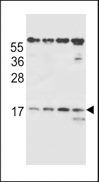 Polyclonal Rabbit anti-Human TCR Beta Antibody (aa67-94, WB)