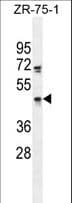 ZNF578 Antibody (aa558-586)