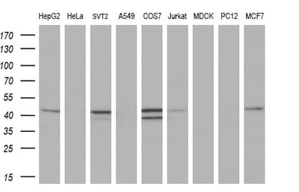 REN / Renin 1 Antibody (aa131-406, clone OTI1A10, Carrier-free)