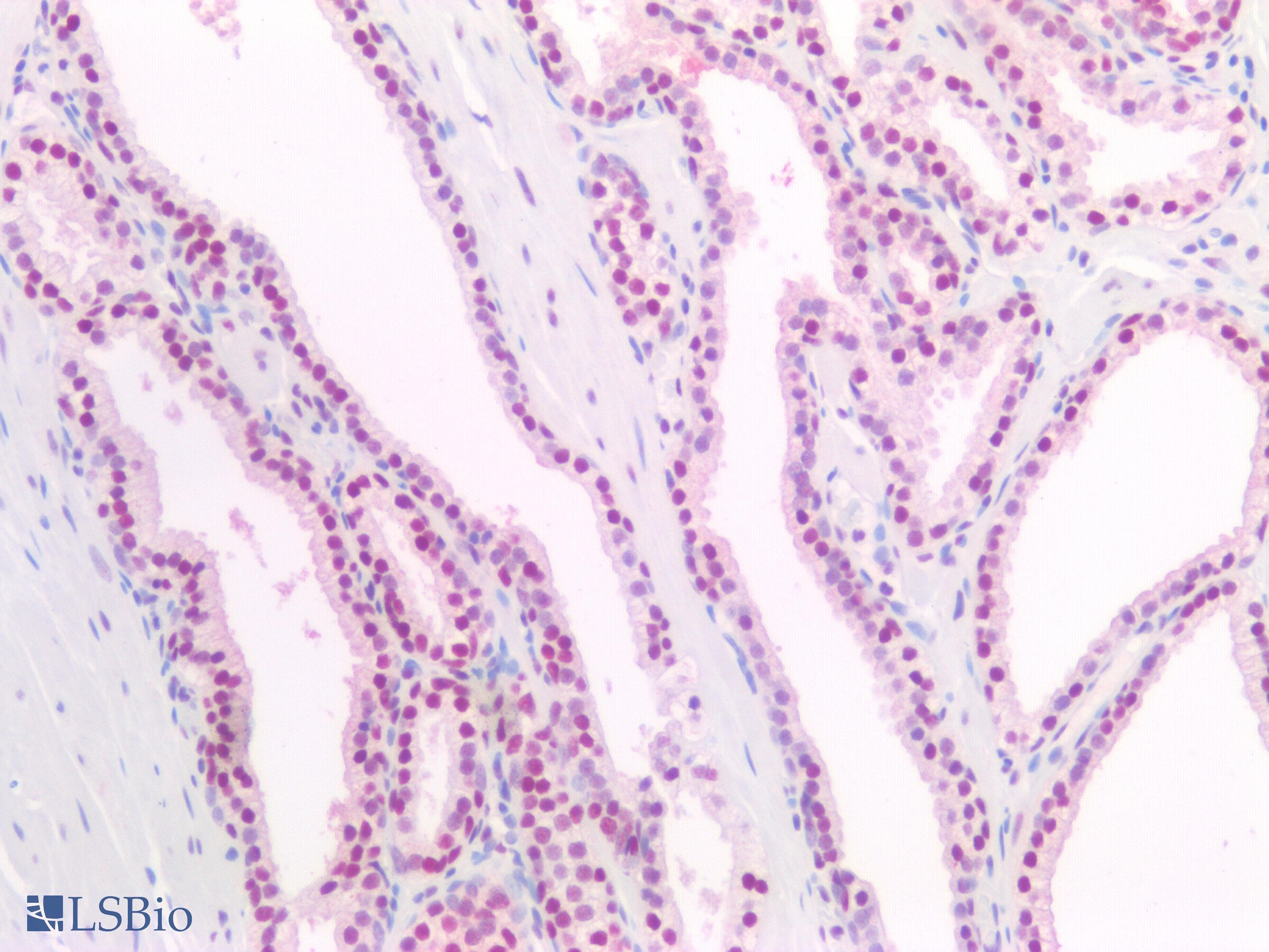 IHC-plus™ PCNA Antibody (clone PCNA/694)
