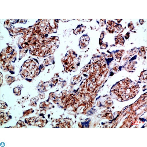 ALK-6 / BMPR1B Antibody