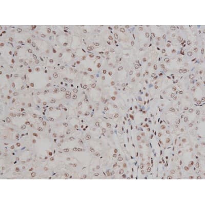 IGF1R / IGF1 Receptor Antibody (phospho-Tyr1346)