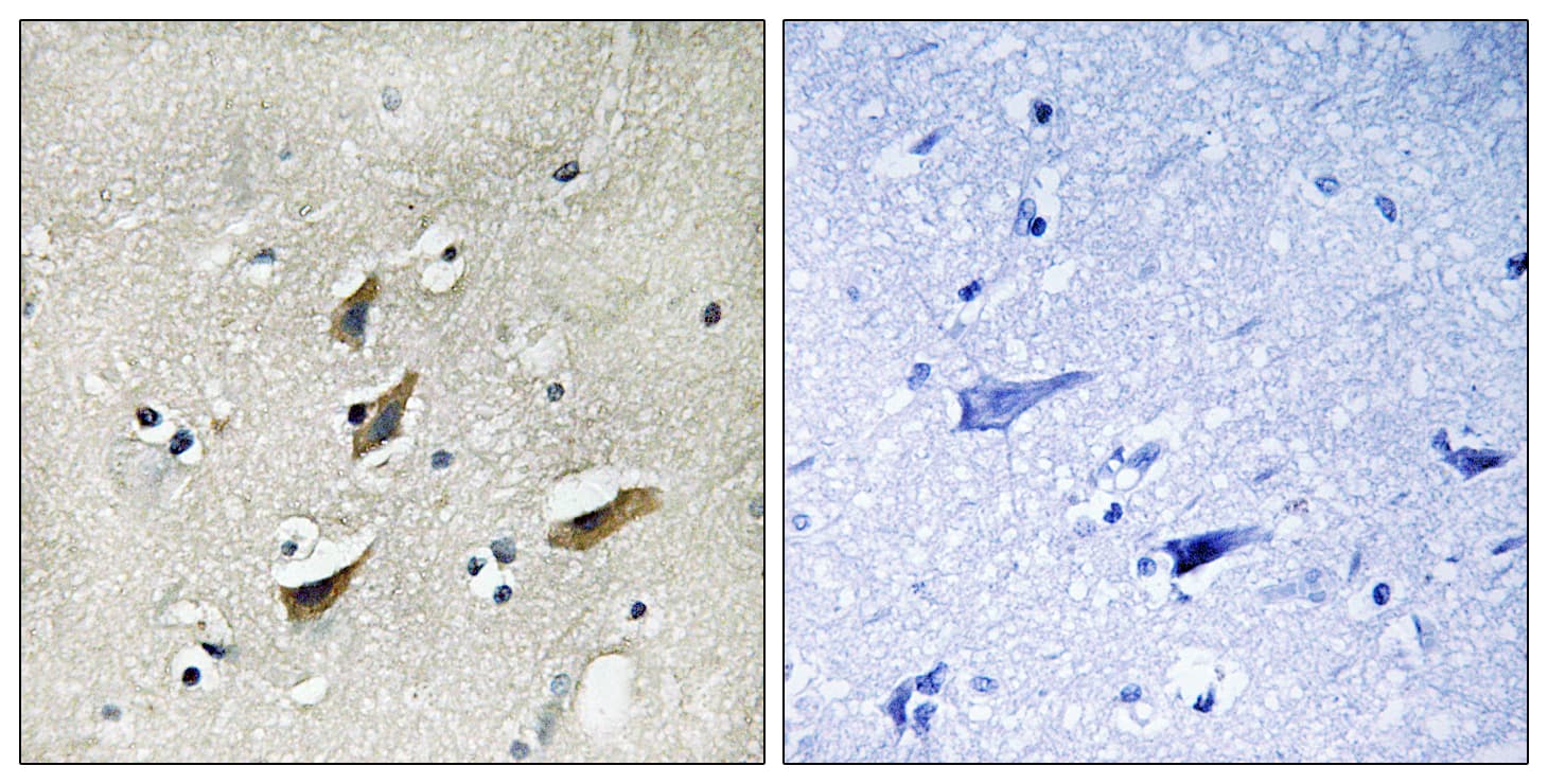 Polyclonal Rabbit anti-Human DMTN / Dematin Antibody (aa356-405, IHC, IF, WB)