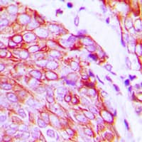 KDR / VEGFR2 / FLK1 Antibody (phospho-Tyr1175)