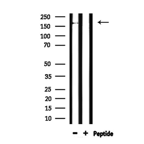 ABCC6 / MRP6 Antibody