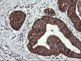 ACAA2 Antibody (clone OTI1D3)