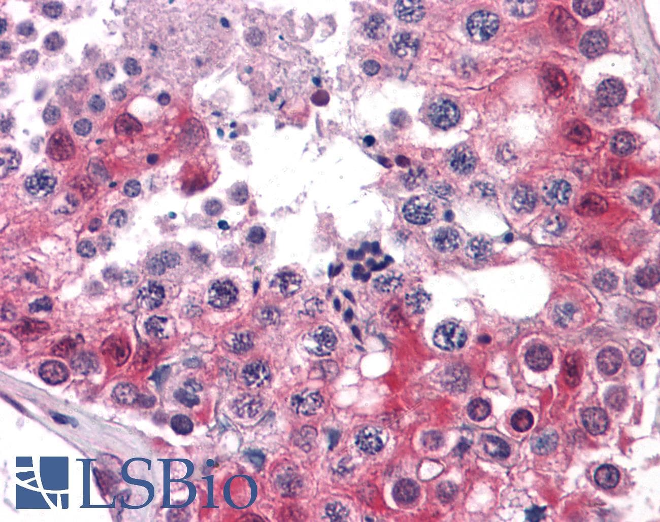 IHC-plus™ ERK1 + ERK2 Antibody (clone 3F8)