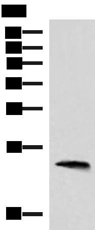 REG1B Antibody