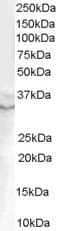 IHC-plus™ GDF15 Antibody (aa286-299)