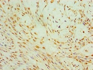 FSP27 / CIDEC Antibody (aa1-238)