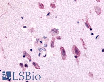 PathPlus™ NEK9 Antibody (Pro/Ser/Thr Rich Domain)