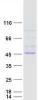 Human RAPSN Protein (Recombinant Myc-DDK (Flag))